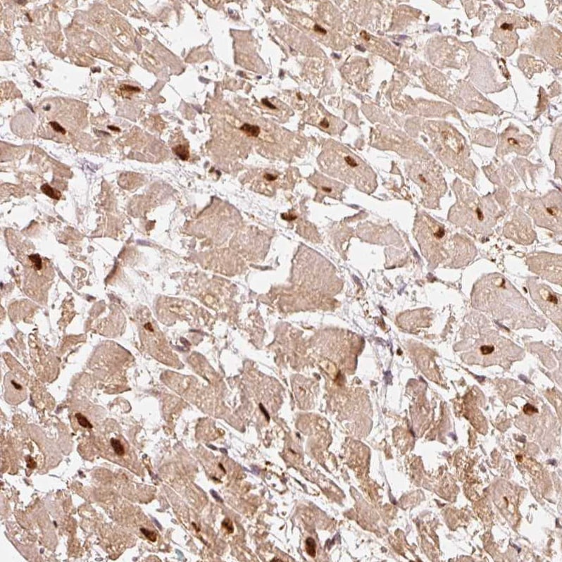 Rpn2 Antibody - BSA Free Immunohistochemistry-Paraffin: Rpn2 Antibody [NBP2-38323]