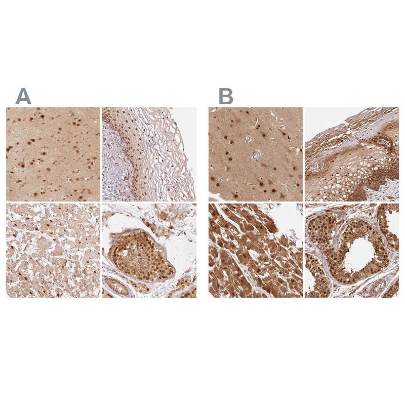 Rpn2 Antibody - BSA Free Immunohistochemistry-Paraffin: Rpn2 Antibody [NBP2-38323]