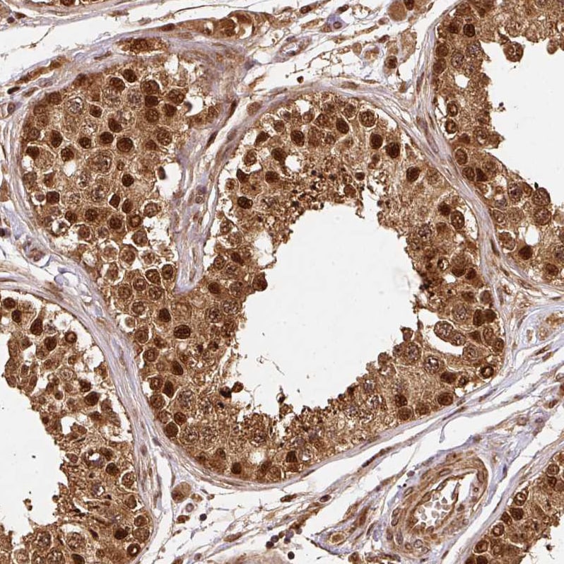 Rpn2 Antibody - BSA Free Immunohistochemistry-Paraffin: Rpn2 Antibody [NBP2-38324]