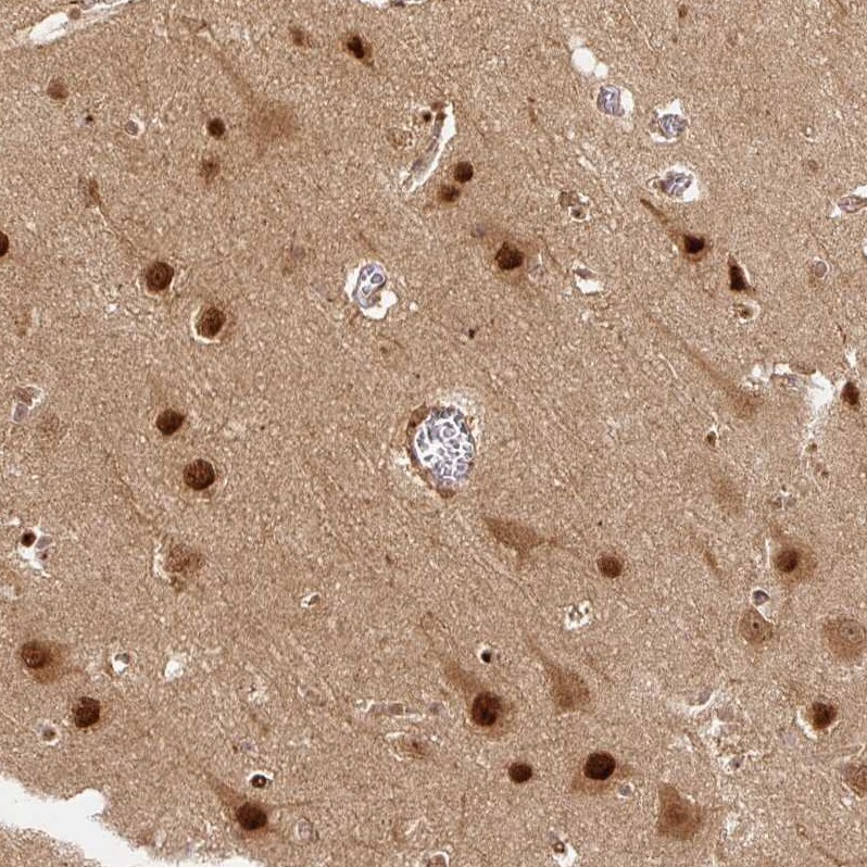 Rpn2 Antibody - BSA Free Immunohistochemistry-Paraffin: Rpn2 Antibody [NBP2-38324]