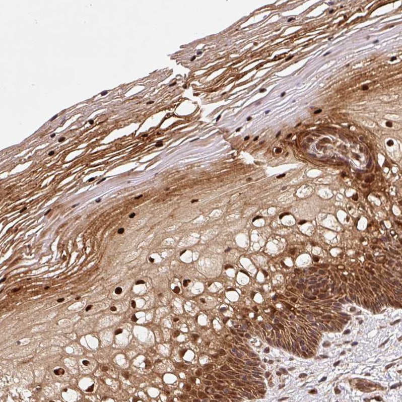 Rpn2 Antibody - BSA Free Immunohistochemistry-Paraffin: Rpn2 Antibody [NBP2-38324]