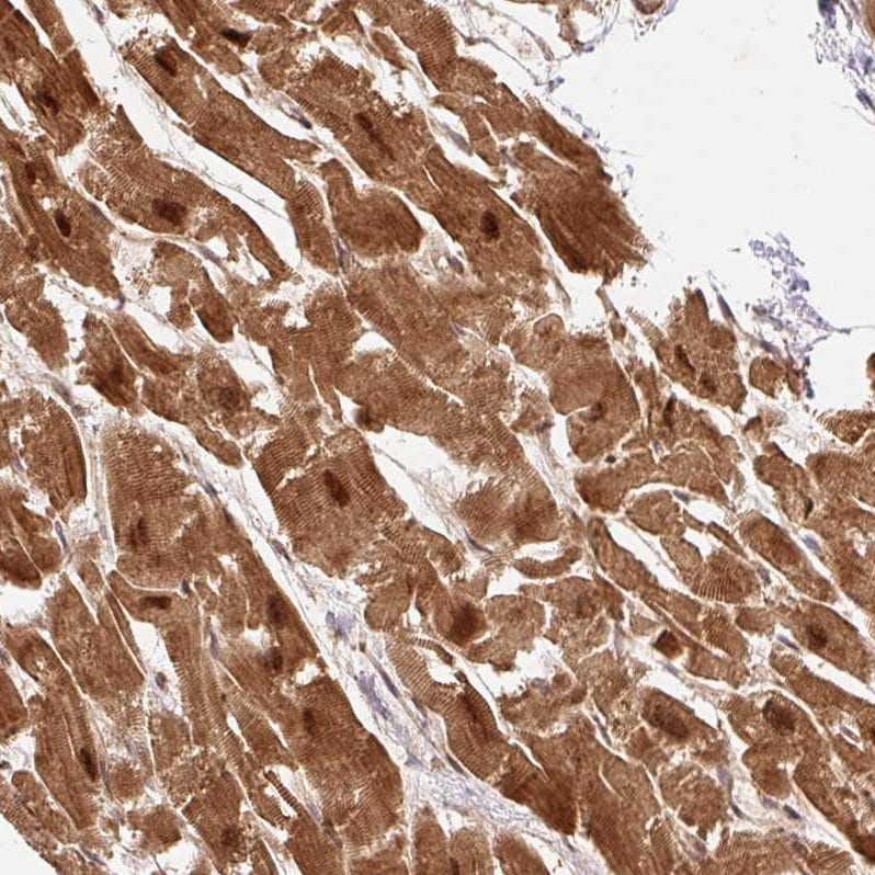 Rpn2 Antibody - BSA Free Immunohistochemistry-Paraffin: Rpn2 Antibody [NBP2-38324]