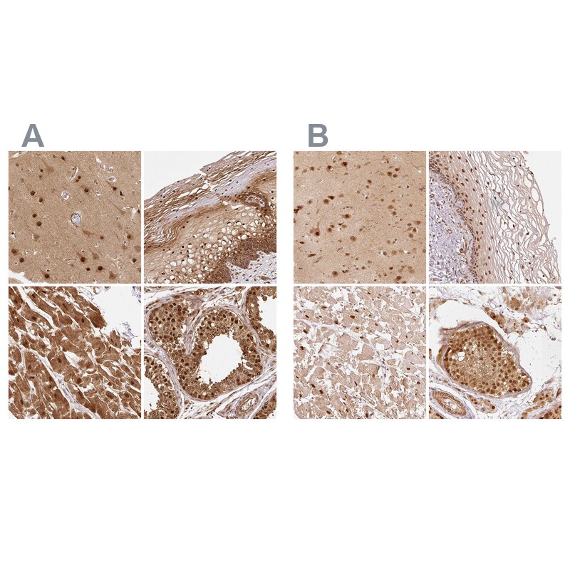 Rpn2 Antibody - BSA Free Immunohistochemistry-Paraffin: Rpn2 Antibody [NBP2-38324]