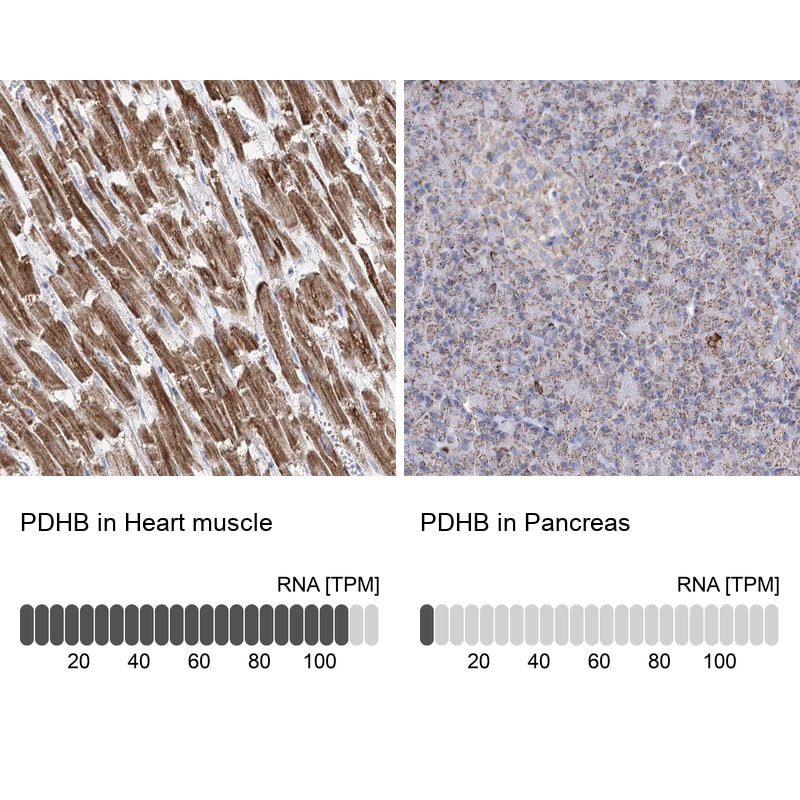 Pyruvate Dehydrogenase E1 beta subunit Antibody - BSA Free Immunohistochemistry-Paraffin: Pyruvate Dehydrogenase E1 beta subunit Antibody [NBP2-38327]