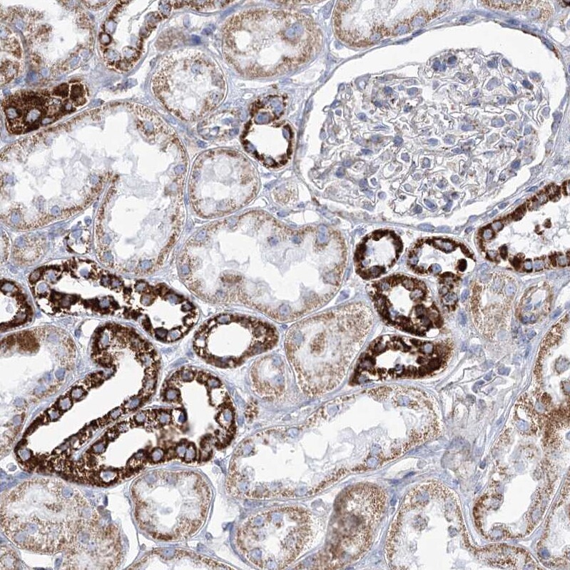 Pyruvate Dehydrogenase E1 beta subunit Antibody - BSA Free Immunohistochemistry-Paraffin: Pyruvate Dehydrogenase E1 beta subunit Antibody [NBP2-38327]