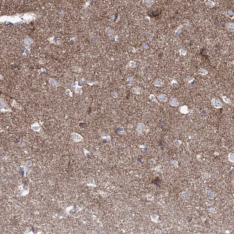 Pyruvate Dehydrogenase E1 beta subunit Antibody - BSA Free Immunohistochemistry-Paraffin: Pyruvate Dehydrogenase E1 beta subunit Antibody [NBP2-38327]
