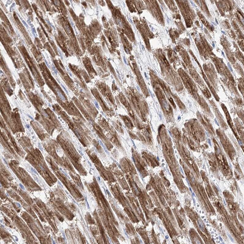 Pyruvate Dehydrogenase E1 beta subunit Antibody - BSA Free Immunohistochemistry-Paraffin: Pyruvate Dehydrogenase E1 beta subunit Antibody [NBP2-38327]