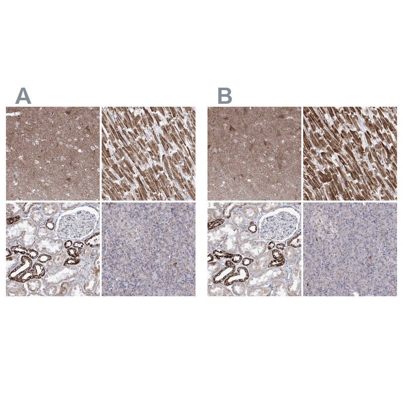 Pyruvate Dehydrogenase E1 beta subunit Antibody - BSA Free Immunohistochemistry-Paraffin: Pyruvate Dehydrogenase E1 beta subunit Antibody [NBP2-38327]