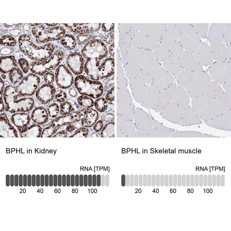 BPHL Antibody - BSA Free Immunohistochemistry-Paraffin: BPHL Antibody [NBP2-38328]
