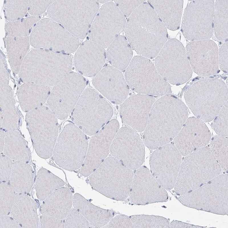 BPHL Antibody - BSA Free Immunohistochemistry-Paraffin: BPHL Antibody [NBP2-38328]