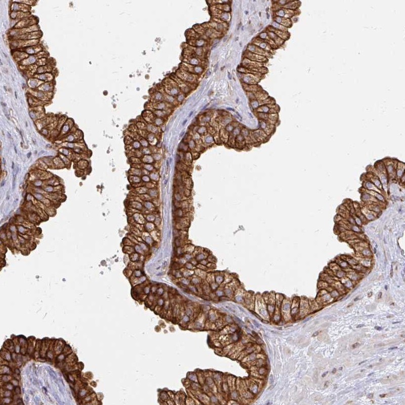 Calpastatin Antibody - BSA Free Immunohistochemistry-Paraffin: Calpastatin Antibody [NBP2-38336]