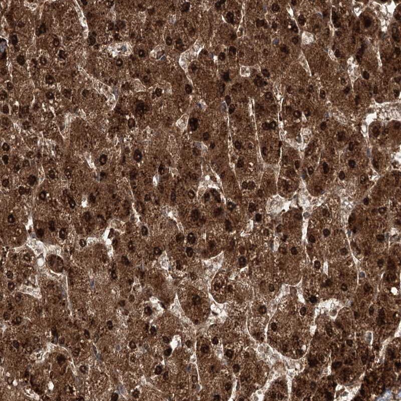 DNAJC13 Antibody - BSA Free Immunohistochemistry: DNAJC13 Antibody - BSA Free [NBP2-38339]