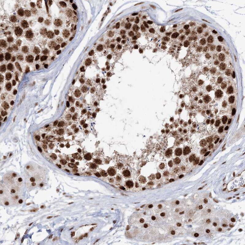 RBM17 Antibody - BSA Free Immunohistochemistry-Paraffin: RBM17 Antibody [NBP2-38348]