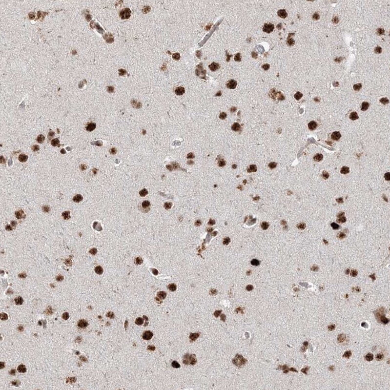 RBM17 Antibody - BSA Free Immunohistochemistry-Paraffin: RBM17 Antibody [NBP2-38348]