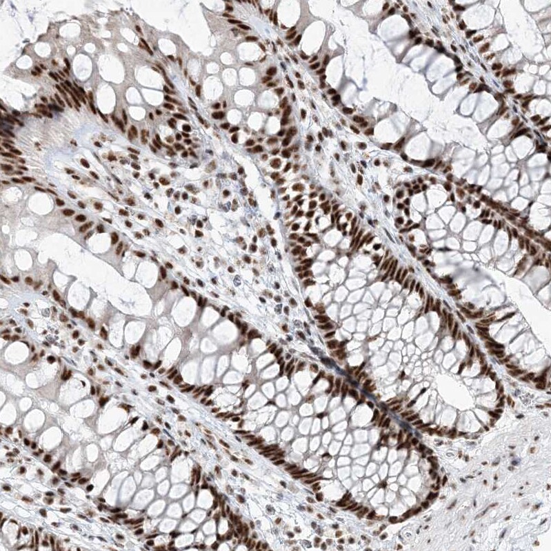 RBM17 Antibody - BSA Free Immunohistochemistry-Paraffin: RBM17 Antibody [NBP2-38348]