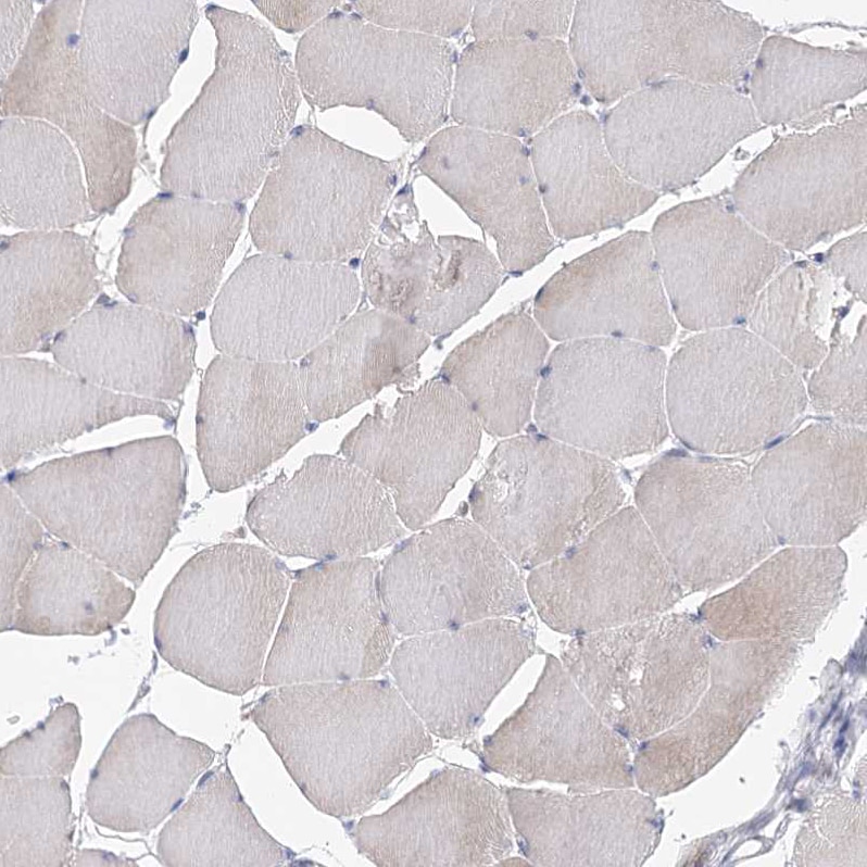 EPB41L5 Antibody - BSA Free Immunohistochemistry-Paraffin: EPB41L5 Antibody [NBP2-38354]