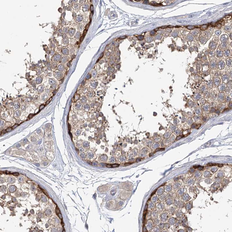 EPB41L5 Antibody - BSA Free Immunohistochemistry-Paraffin: EPB41L5 Antibody [NBP2-38354]