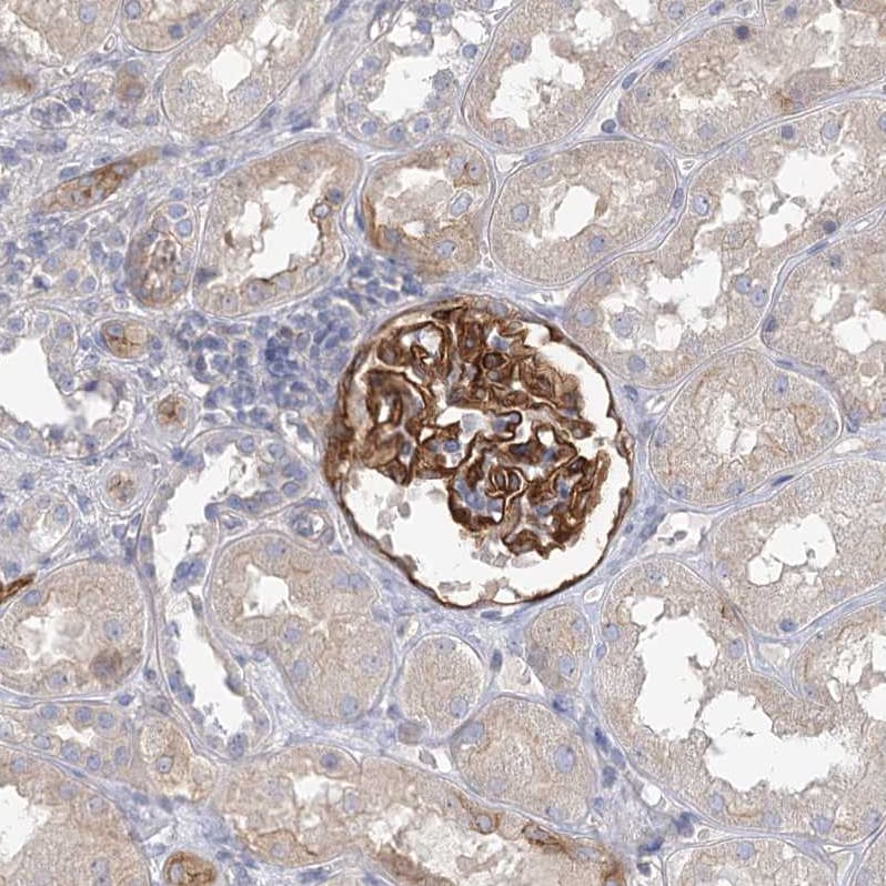 EPB41L5 Antibody - BSA Free Immunohistochemistry-Paraffin: EPB41L5 Antibody [NBP2-38354]