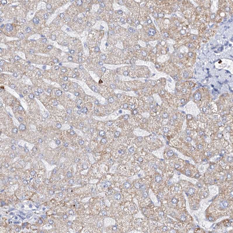 EPB41L5 Antibody - BSA Free Immunohistochemistry-Paraffin: EPB41L5 Antibody [NBP2-38354]