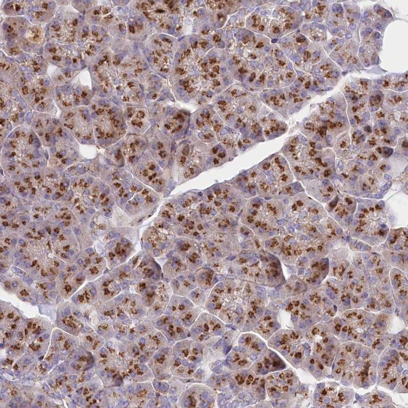 ABRO Antibody - BSA Free Immunohistochemistry: ABRO Antibody - BSA Free [NBP2-38355]