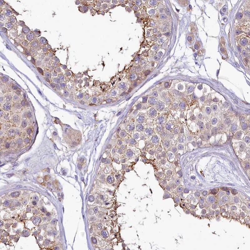 SH3TC2 Antibody - BSA Free Immunohistochemistry-Paraffin: SH3TC2 Antibody [NBP2-38360]