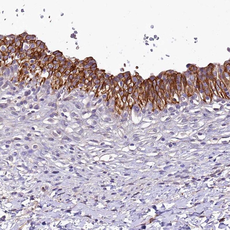 SH3TC2 Antibody - BSA Free Immunohistochemistry-Paraffin: SH3TC2 Antibody [NBP2-38360]