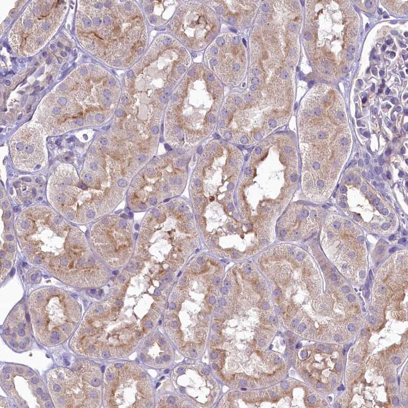 SH3TC2 Antibody - BSA Free Immunohistochemistry-Paraffin: SH3TC2 Antibody [NBP2-38360]
