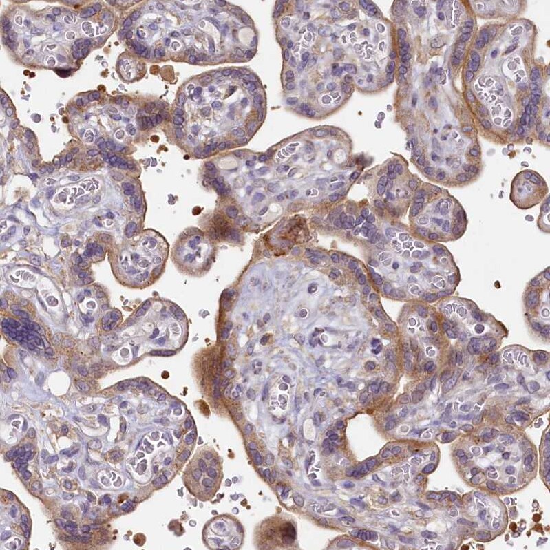 SH3TC2 Antibody - BSA Free Immunohistochemistry-Paraffin: SH3TC2 Antibody [NBP2-38360]