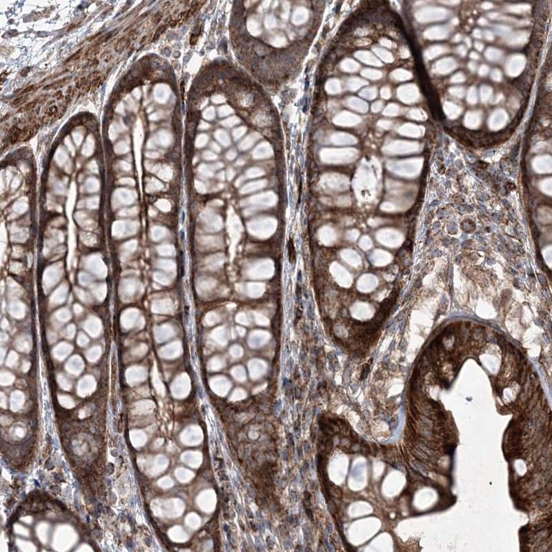 Rictor Antibody - BSA Free Immunohistochemistry: Rictor Antibody - BSA Free [NBP2-38365]