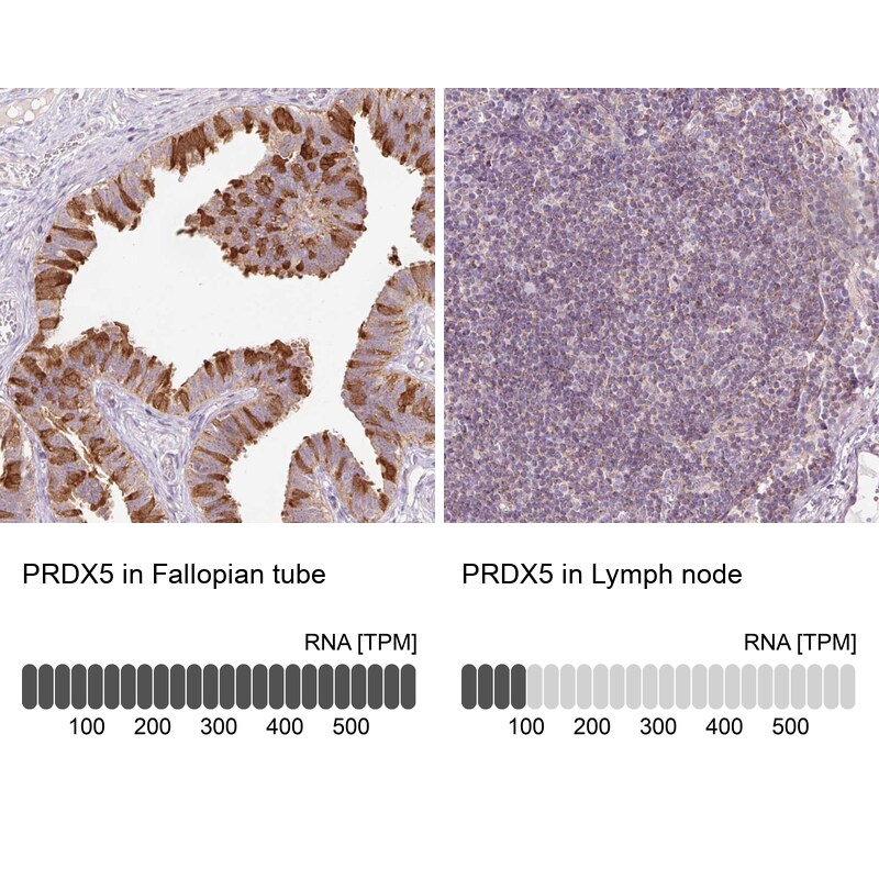 Peroxiredoxin 5 Antibody - BSA Free Immunohistochemistry-Paraffin: Peroxiredoxin 5 Antibody [NBP2-38370]