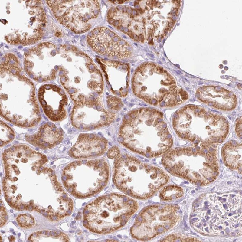Peroxiredoxin 5 Antibody - BSA Free Immunohistochemistry-Paraffin: Peroxiredoxin 5 Antibody [NBP2-38370]