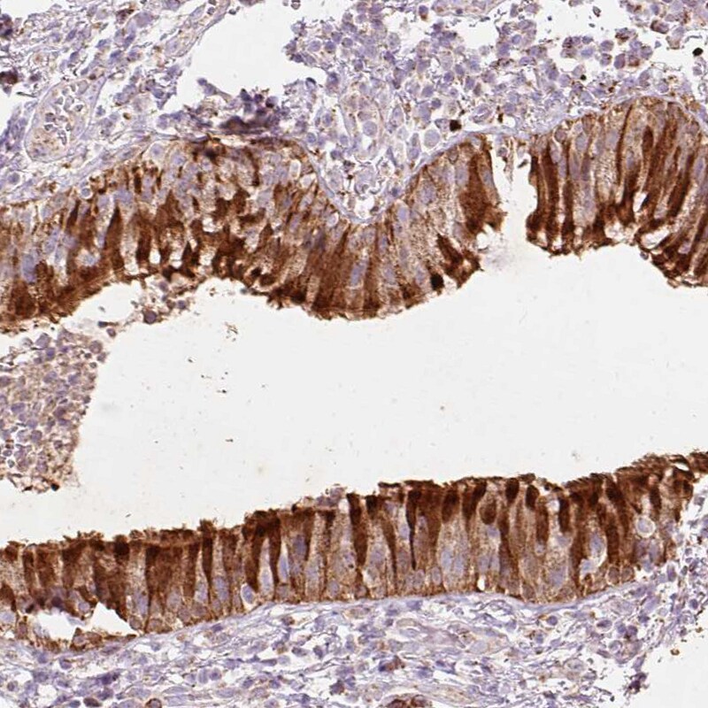 Peroxiredoxin 5 Antibody - BSA Free Immunohistochemistry-Paraffin: Peroxiredoxin 5 Antibody [NBP2-38370]