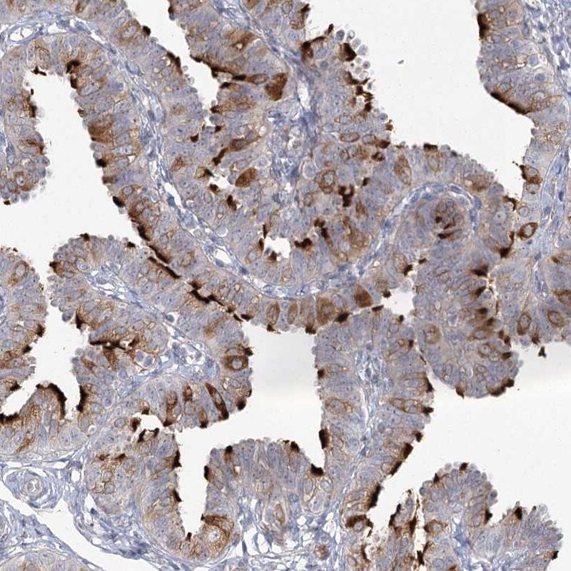 ENO4 Antibody - BSA Free Immunohistochemistry-Paraffin: ENO4 Antibody [NBP2-38373]