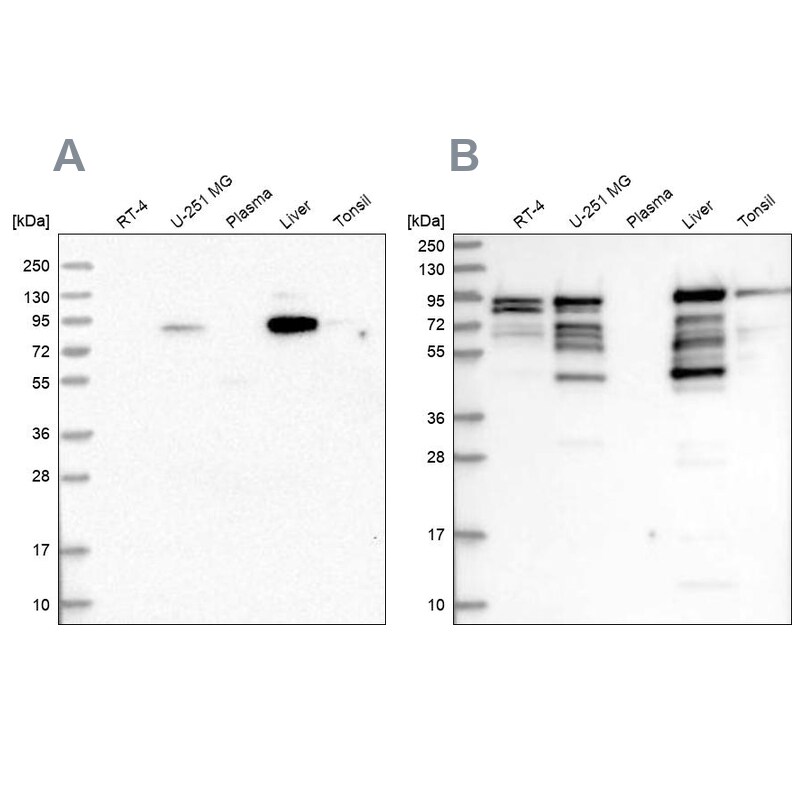 shootin-1 Antibody Western Blot: shootin-1 Antibody Antibody [NBP2-38374]