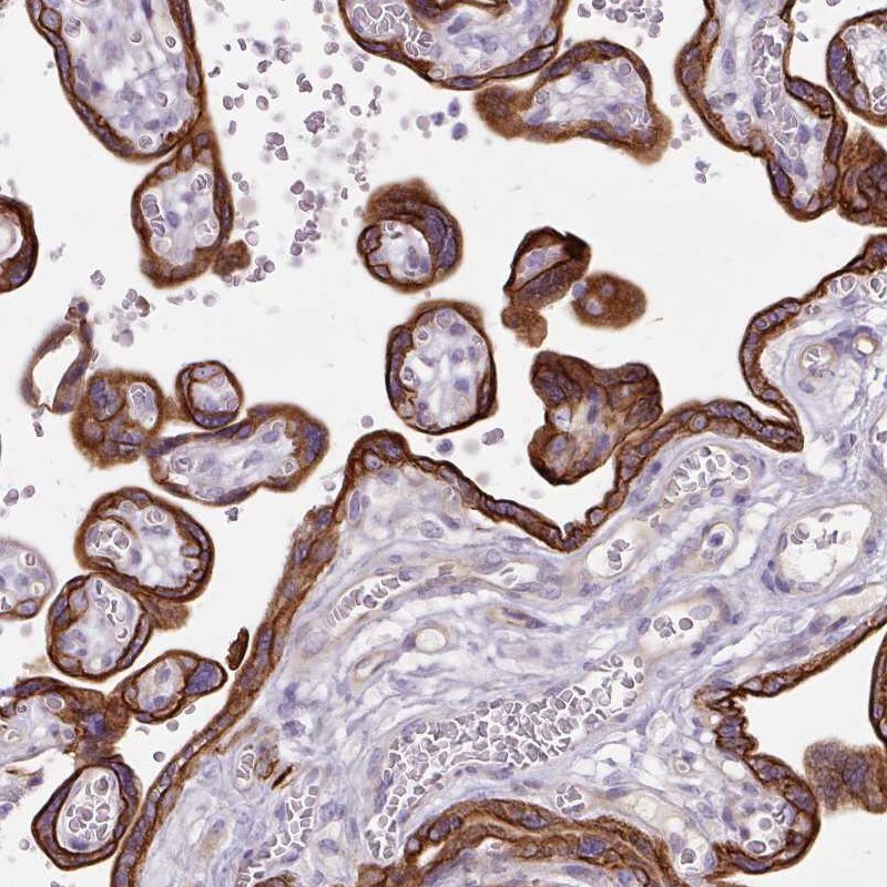 dynactin 4 Antibody - BSA Free Immunohistochemistry-Paraffin: dynactin 4 Antibody [NBP2-38378]