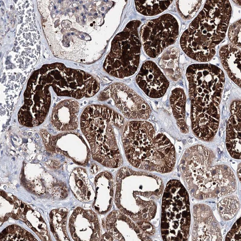 PTER Antibody - BSA Free Immunohistochemistry-Paraffin: PTER Antibody [NBP2-38380]