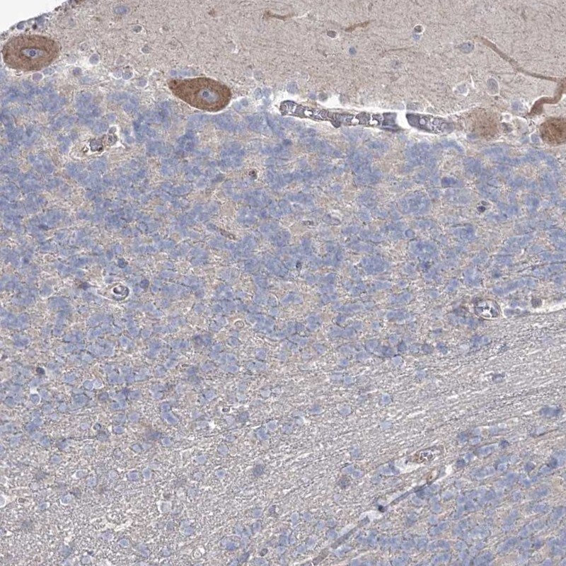 SH3BP5L Antibody - BSA Free Immunohistochemistry-Paraffin: SH3BP5L Antibody [NBP2-38385]