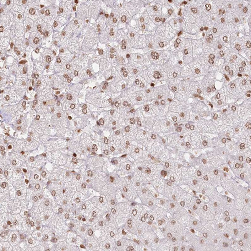 FAM13A Antibody - BSA Free Immunohistochemistry-Paraffin: FAM13A Antibody [NBP2-38388]