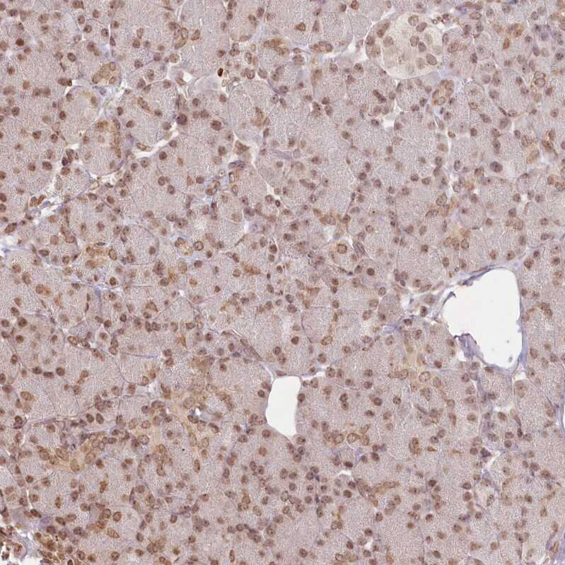 FAM13A Antibody - BSA Free Immunohistochemistry-Paraffin: FAM13A Antibody [NBP2-38388]