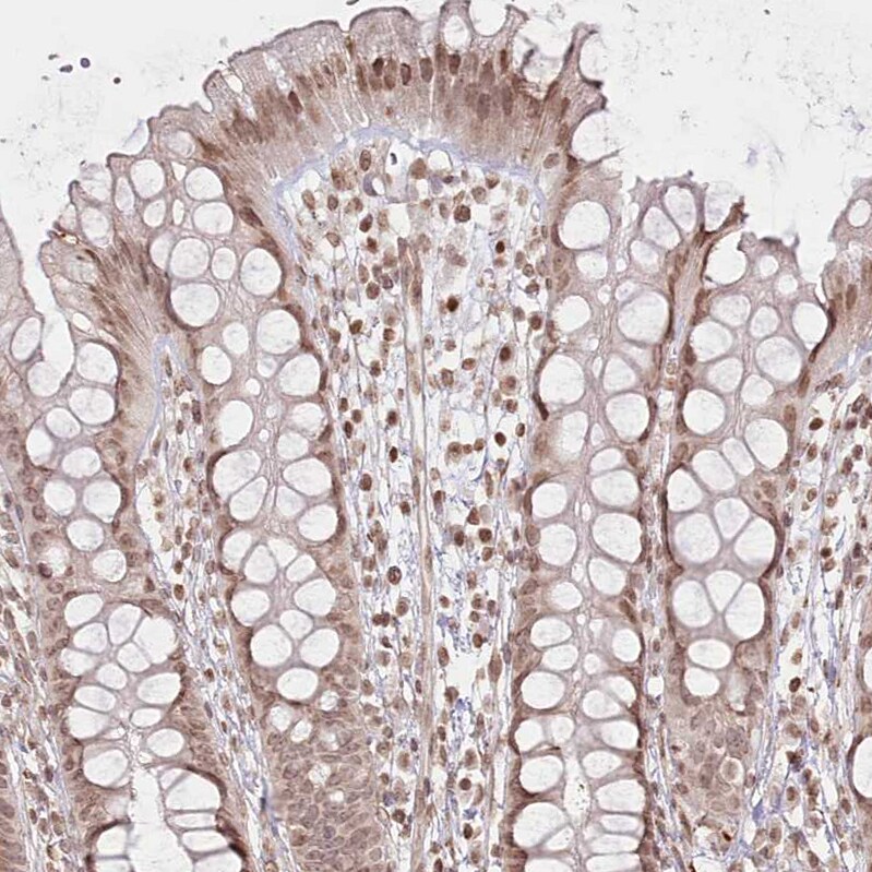 FAM13A Antibody - BSA Free Immunohistochemistry-Paraffin: FAM13A Antibody [NBP2-38388]