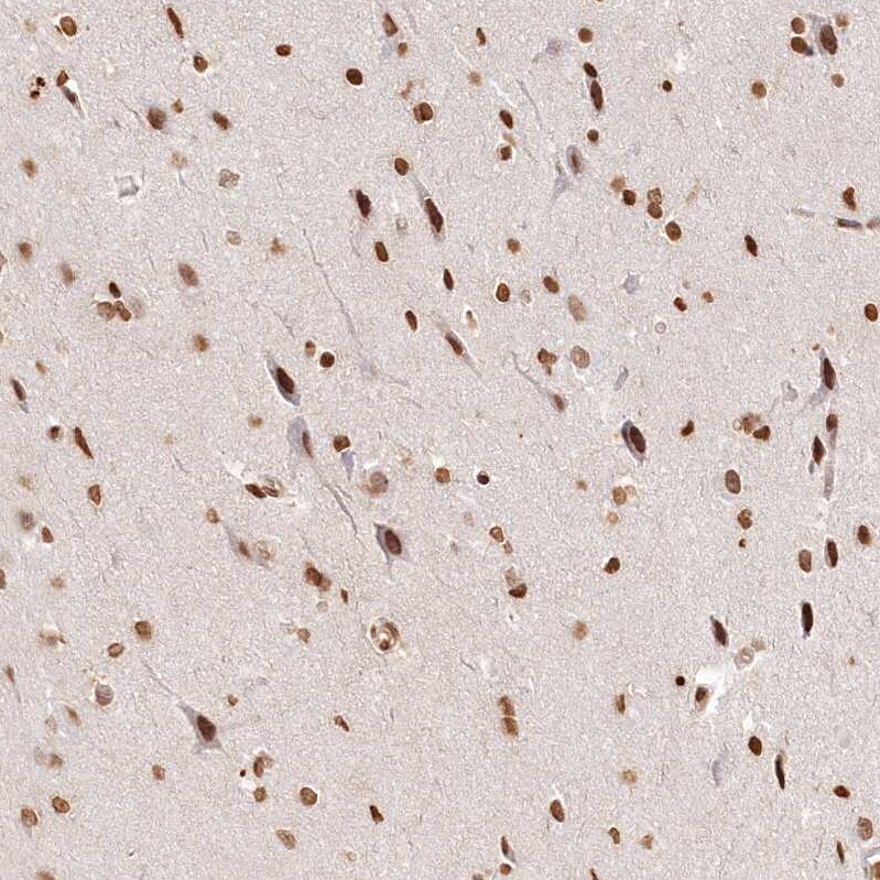 FAM13A Antibody - BSA Free Immunohistochemistry-Paraffin: FAM13A Antibody [NBP2-38388]