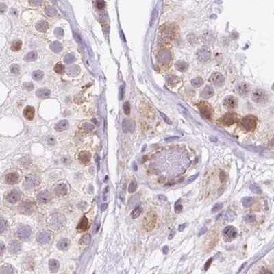 HIP1 Related Antibody - BSA Free Immunohistochemistry-Paraffin: HIP1 Related Antibody [NBP2-38390]