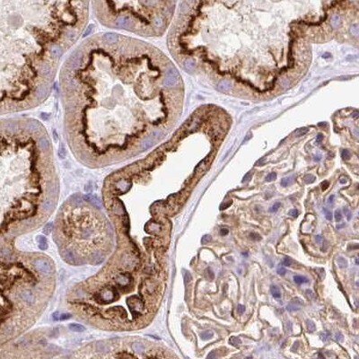 HIP1 Related Antibody - BSA Free Immunohistochemistry-Paraffin: HIP1 Related Antibody [NBP2-38390]