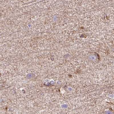 HIP1 Related Antibody - BSA Free Immunohistochemistry-Paraffin: HIP1 Related Antibody [NBP2-38390]