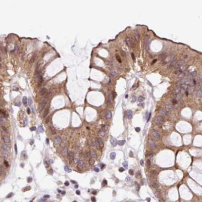 HIP1 Related Antibody - BSA Free Immunohistochemistry-Paraffin: HIP1 Related Antibody [NBP2-38390]