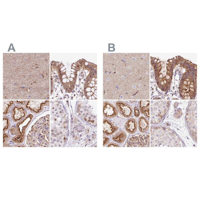 HIP1 Related Antibody - BSA Free Immunohistochemistry-Paraffin: HIP1 Related Antibody [NBP2-38390]