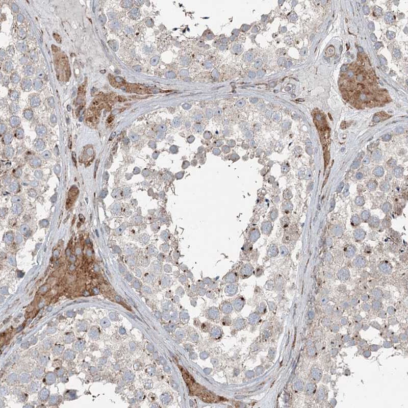 RASSF8 Antibody - BSA Free Immunohistochemistry: RASSF8 Antibody - BSA Free [NBP2-38395]