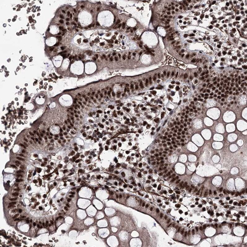 FNBP3 Antibody - BSA Free Immunohistochemistry-Paraffin: FNBP3 Antibody [NBP2-38400]