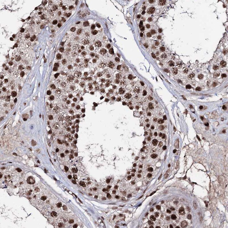 FNBP3 Antibody - BSA Free Immunohistochemistry-Paraffin: FNBP3 Antibody [NBP2-38400]