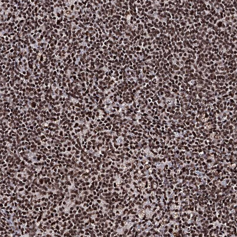 FNBP3 Antibody - BSA Free Immunohistochemistry-Paraffin: FNBP3 Antibody [NBP2-38400]
